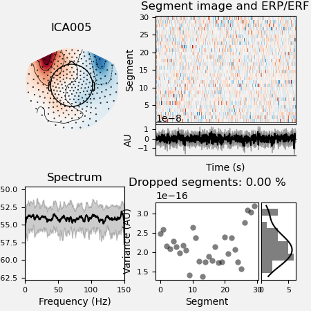 ICA005, Segment image and ERP/ERF, Spectrum, Dropped segments: 0.00 %